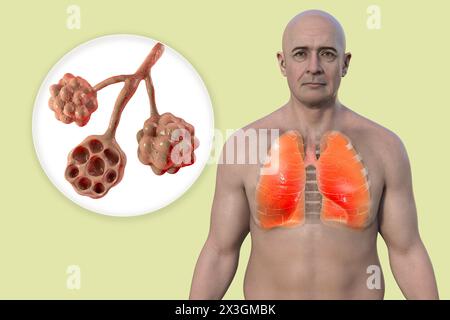 Illustrazione di un uomo con polmoni sani insieme a vista ravvicinata di alveoli polmonari. Foto Stock