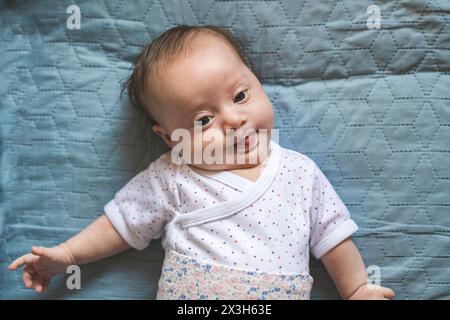 Bambina con la sindrome di Down che guarda la telecamera Foto Stock