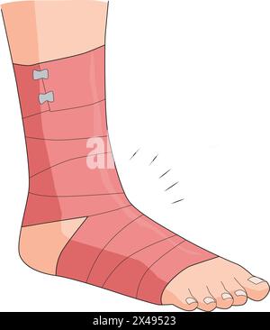 Gamba fratturata avvolta con bendaggio Illustrazione Vettoriale
