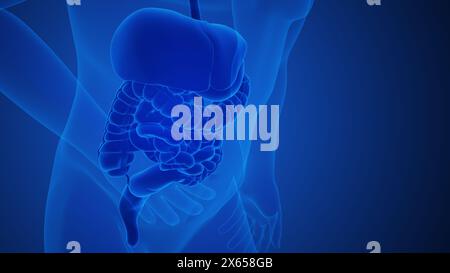 Appendice infiammazione dolore anatomia per concetto medico Foto Stock