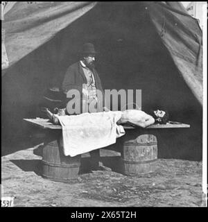 Dr. Richard Burr, un chirurgo di imbalsamazione nell'Armata del James che dimostra la procedura su un soldato morto, fotografie della Guerra civile 1861-1865 Foto Stock