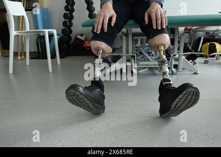 un uomo con protesi delle gambe impiantate nell'osso. osteointegrazione Foto Stock