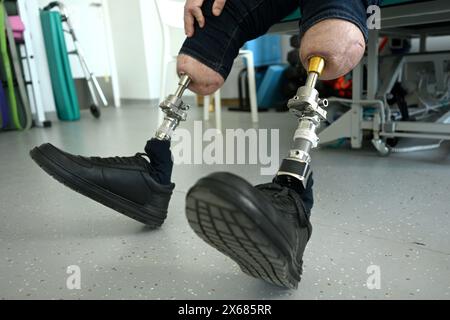 un uomo con protesi delle gambe impiantate nell'osso. osteointegrazione Foto Stock