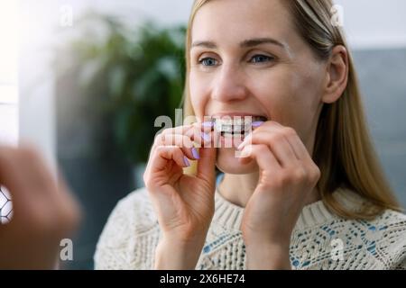 donna che inserisce allineatori dentari invisibili trasparenti per raddrizzare i denti storti Foto Stock