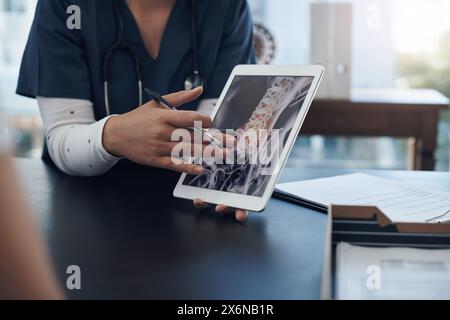 Mani, paziente e medico, con tablet, raggi x e consultazione con Internet, feedback e diagnosi. Schermo, professionisti e persone con tecnologia, recensione Foto Stock