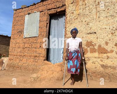 Calulo, Angola. 3 maggio 2024. La piccola contadina Ana José Capagaio (37) si trova di fronte alla sua casa nel villaggio di Calulo, nella provincia angolana di Kwanza sul. La madre single di sette bambini ha calpestato una mina mentre cercava legna da ardere e ha perso la gamba sinistra. Disinnescare le mine terrestri è un compito laborioso. Ora i topi giganti dei criceti stanno aiutando a liberare gli esplosivi. Credito: Kristin Palitza/dpa/Alamy Live News Foto Stock