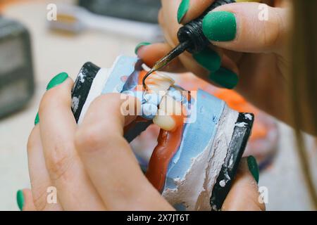 Un odontotecnico lavora con cera fusa calda per creare una dentatura. Primo piano. Foto Stock