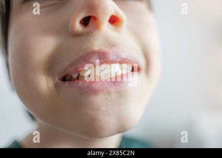 l'adolescente di 12 anni mostra oscillazioni e dolori dei denti, nozione odontoiatria pediatrica, trattamento dentale e correzione dell'occlusione, cura orale, trattamento di Foto Stock