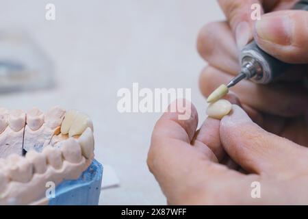 Un odontotecnico sta tagliando un dente con le forbici per la produzione di protesi in questo video di primo piano. Foto Stock