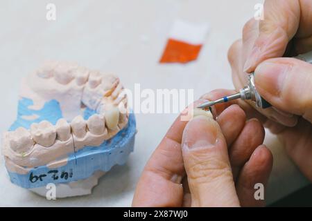 Un odontotecnico sta tagliando un dente con le forbici per la produzione di protesi in questo video di primo piano. Foto Stock