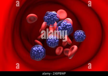 Linfoma diffuso a grandi cellule B (DLBCL) - Vista in sezione illustrazione 3d. Foto Stock