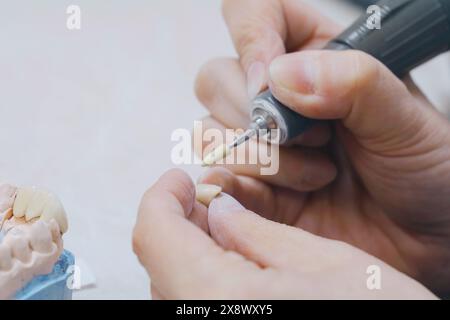 Un odontotecnico sta tagliando un dente con le forbici per la produzione di protesi in questo video di primo piano. Foto Stock