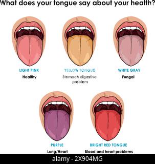 Insieme di illustrazioni vettoriali dei segni di salute di Tongue Illustrazione Vettoriale