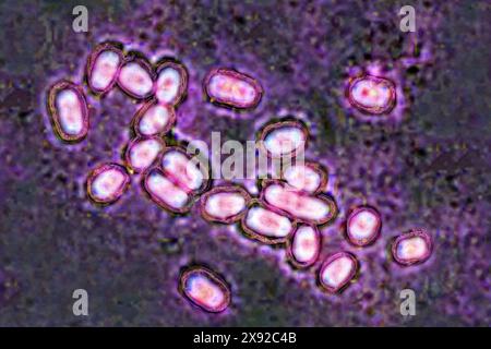 Lo pneumococco Streptococcus pneumoniae, pneumococcus è un batterio coinvolto in polmonite, broncopolmonite, pleurite purulenta, meningite batterica, otite, sinusite e congiuntivite. Immagine prodotta da microscopia ottica. Pneumococco 016813 026 Foto Stock