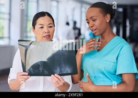 Team medico diversificato che analizza i raggi X in ambiente ospedaliero Foto Stock