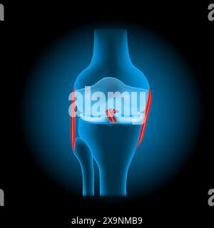 lesioni ai legamenti del ginocchio. Giunto del ginocchio umano blu trasparente realistico con effetto luminoso su sfondo scuro. Illustrazione vettoriale come immagine a raggi X. Illustrazione Vettoriale