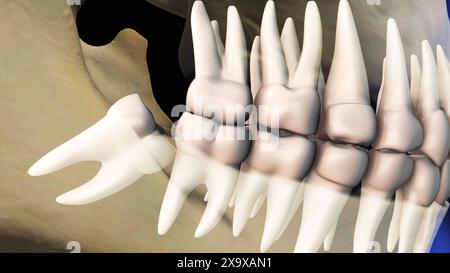 Concetto di saggezza denti dolore Foto Stock