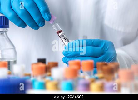 Scienziato che tiene un campione di sangue in un laboratorio Foto Stock