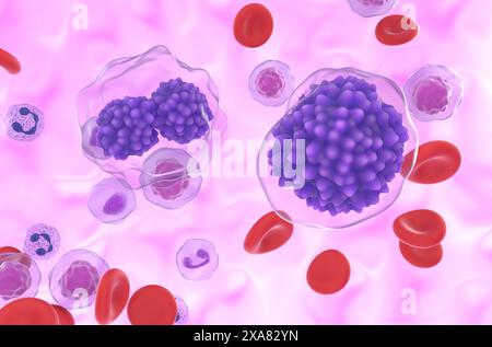 Leucemia plasmacellulare (PCL) - Vista ravvicinata illustrazione 3d. Foto Stock