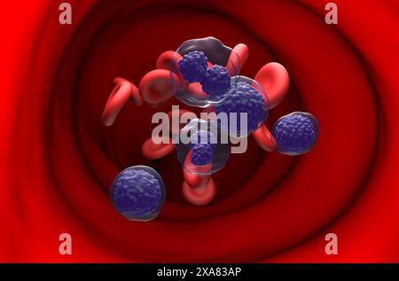 Leucemia plasmacellulare (PCL) - Vista in sezione illustrazione 3d. Foto Stock