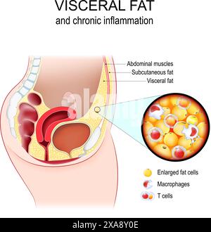 Grasso viscerale e infiammazione cronica. Sezione trasversale dell'addome femminile con muscolo addominale, grasso sottocutaneo e viscerale. Primo piano della tiss adiposa Illustrazione Vettoriale