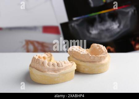 Modello odontoiatrico con gengive su tavolo bianco contro raggi X panoramici. Fusione di denti Foto Stock