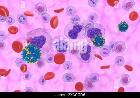 Terapia a cellule T di CAR nella leucemia a cellule del plasma (PCL) - Vista isometrica illustrazione 3d. Foto Stock