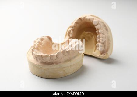 Modello dentale con gengive su sfondo grigio chiaro. Fusione di denti Foto Stock