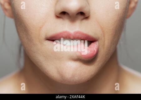 Primo piano dettagliato di un viso femminile parziale che mostra un sorriso con denti e labbra visibili. L'immagine acquisisce sottili texture facciali e sottolinea de Foto Stock