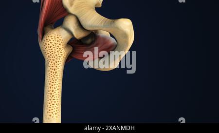 Processo di osteoporosi nell'osso della gamba Foto Stock