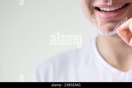 giovane sorridente con denti bianchi dritti che tengono l'allineatore trasparente davanti ai denti, focalizzazione selettiva sull'allineatore isolato Foto Stock