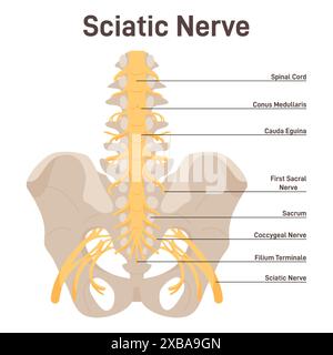 Nervo sciatico. Parte inferiore della schiena e degli arti inferiori nervo ischiadico. Poster educativo o informativo del sistema nervoso umano. Illustrazione vettoriale piatta Illustrazione Vettoriale