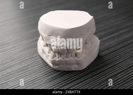 Modello odontoiatrico con gengive su tavolo in legno grigio. Fusione di denti Foto Stock