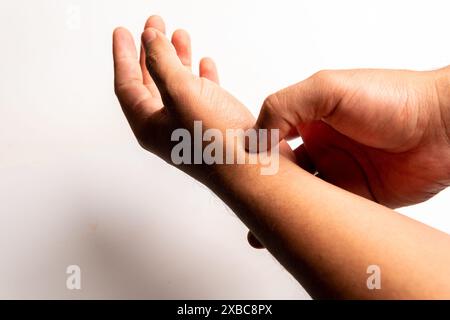 Primo piano della mano di un uomo affetto da dolore, sindrome del tunnel carpale, tendinite, stress, osteoartrite, spruzzi e deformazioni Foto Stock