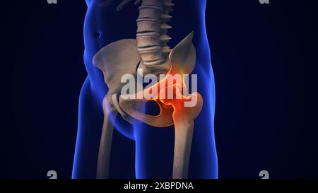 Anatomia del trattamento dell'articolazione dell'anca umana Foto Stock