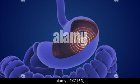 Trasmissione wireless ed endoscopia delle capsule Foto Stock