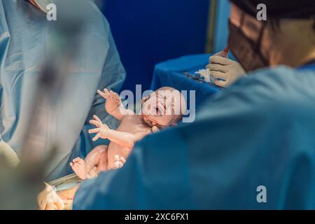 Un bambino viene partorito durante un taglio cesareo. La procedura chirurgica viene condotta in una sala operatoria sterile con un team medico qualificato, assicurando Foto Stock