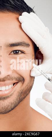 Uomo, mano e segni di disegno sul viso per chirurgia plastica, rinoplastica e procedura cosmetica in studio. Persona maschile, chirurgo e ago o siringa Foto Stock