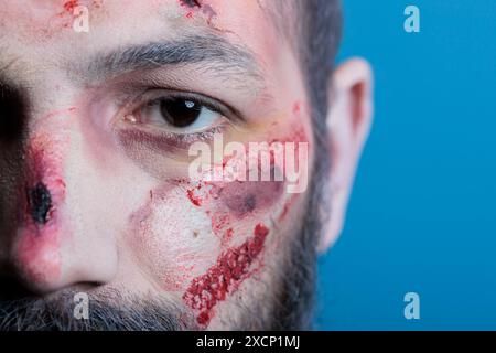 Ritratto di un uomo ferito in angoscia pieno di lividi sanguinosi, vittima di violenza domestica a casa, ferito. Primo piano di occhi neri e cicatrici sulla persona ferita, sfondo dello studio Foto Stock