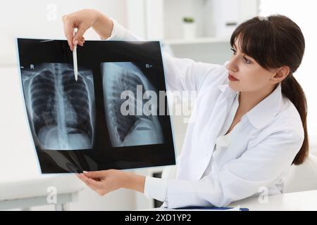 Malattia polmonare. Medico che mostra radiografia toracica in clinica Foto Stock