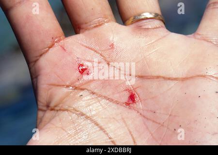 Ferita sanguinante sulla mano di un uomo a seguito di un incidente. Macro di tagli sulla pelle umana con perdita di sangue. Concetto di incidenti sul lavoro. Foto Stock