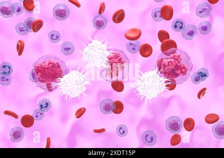 Le cellule dendritiche (DC) riconoscono la leucemia linfocitica acuta (TUTTE) - Vista isometrica illustrazione 3d. Foto Stock