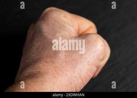 dettagli della mano di un uomo in primo piano, parte della mano di un uomo con lentiggini Foto Stock