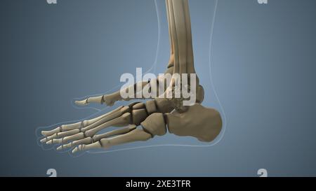 Cancro che si diffonde lungo un osso tarsico Foto Stock