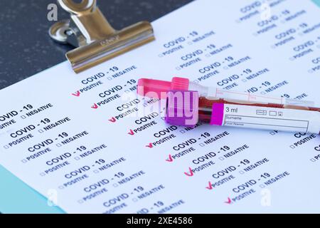 Rapporto di rilevamento della malattia di Covid-19 e provetta di test con sangue reale. Casella di controllo COVID 19 per positivo B. Foto Stock