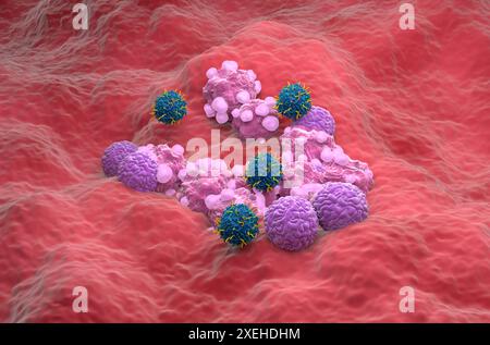 Terapia con cellule T di CAR nel cancro ovarico - Vista isometrica illustrazione 3d. Foto Stock