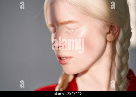 Incluso il viso di una ragazza albino illuminata dal sole su sfondo bianco. Primo piano. Foto Stock