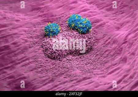 Terapia con cellule T di CAR nel cancro del fegato - Vista isometrica illustrazione 3d. Foto Stock