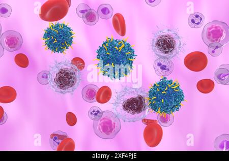 Terapia con cellule T di CAR nella leucemia a cellule pelose (HCL) - Vista isometrica illustrazione 3d. Foto Stock