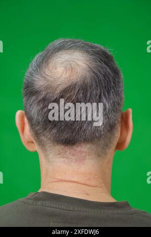 Un uomo con i capelli diradati sta in piedi con le spalle allo spettatore, su uno sfondo verde Foto Stock